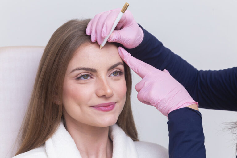Botox Forehead Lines before